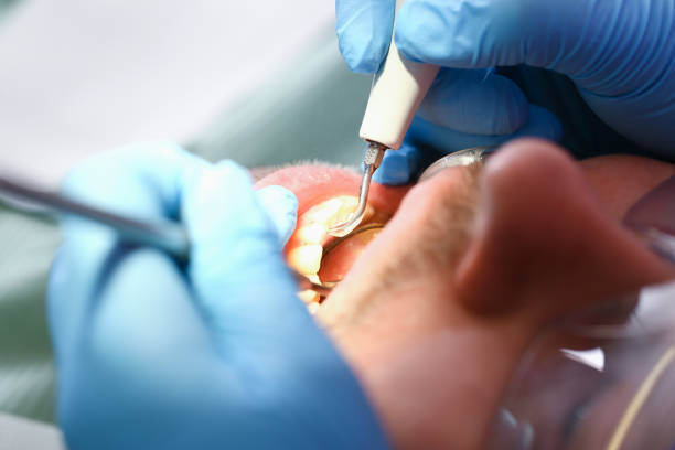 Best Emergency Gum Treatment in Lake Catherine, IL
