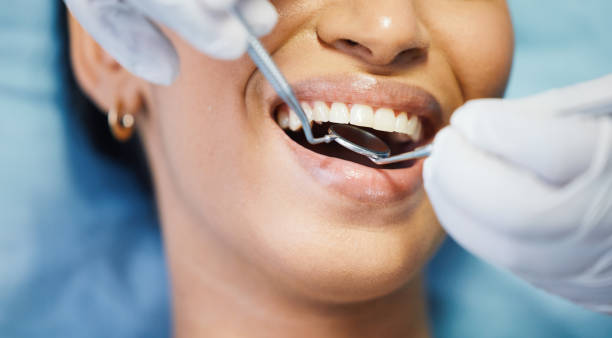 Best Cosmetic Emergency Dentistry in Lake Catherine, IL
