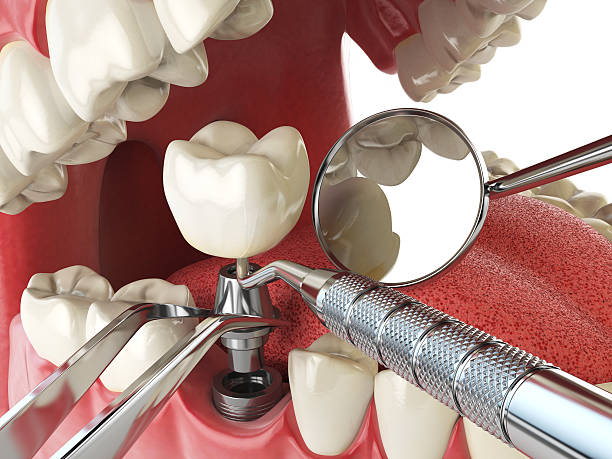 Best Same-Day Emergency Dental Services in Lake Catherine, IL
