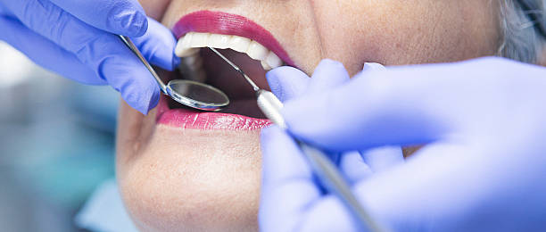 Best Same-Day Emergency Dental Services in Lake Catherine, IL